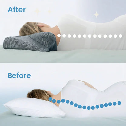 OpenFlow™ Sleep Apnea Pillow